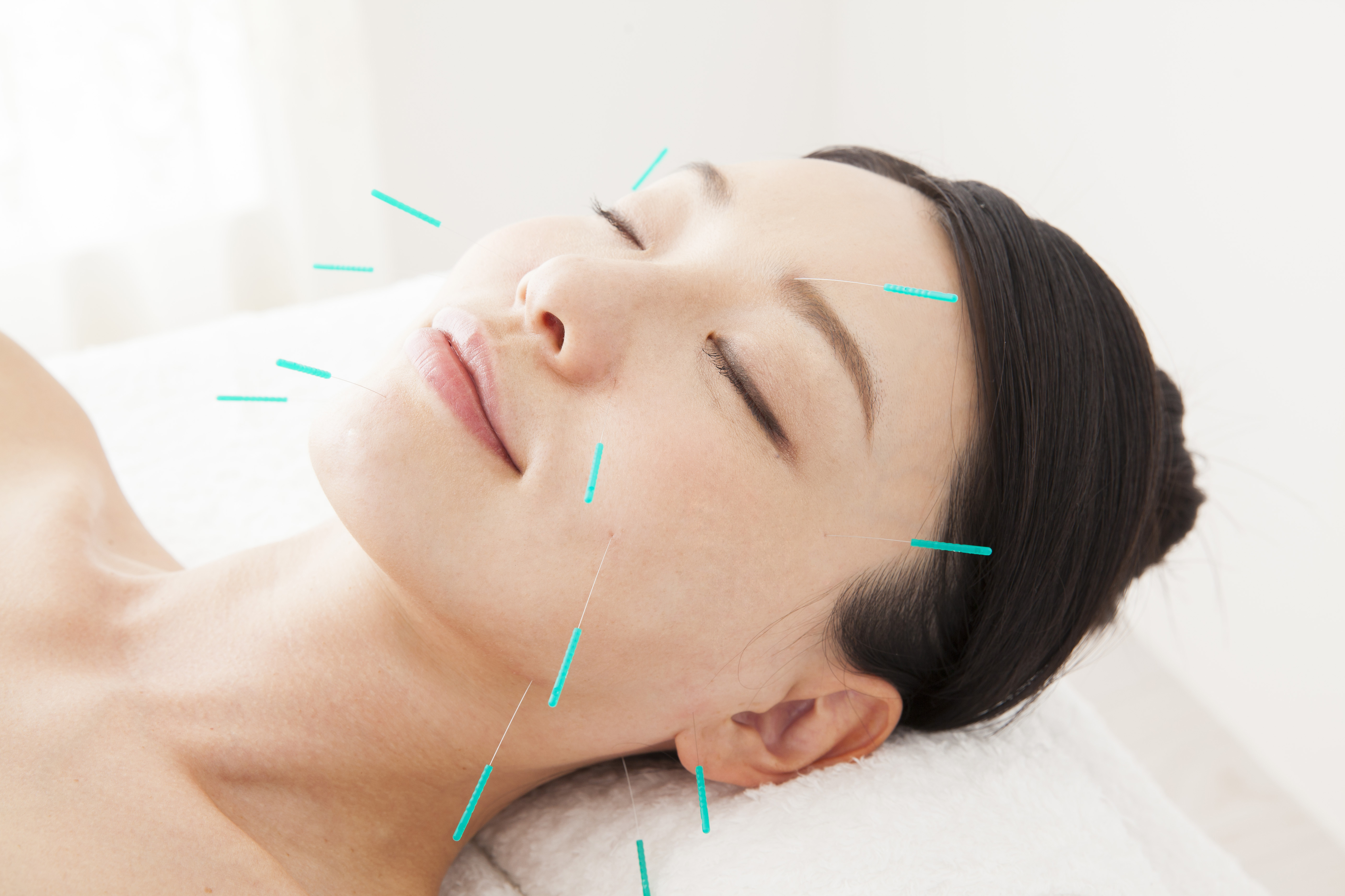 美容鍼灸